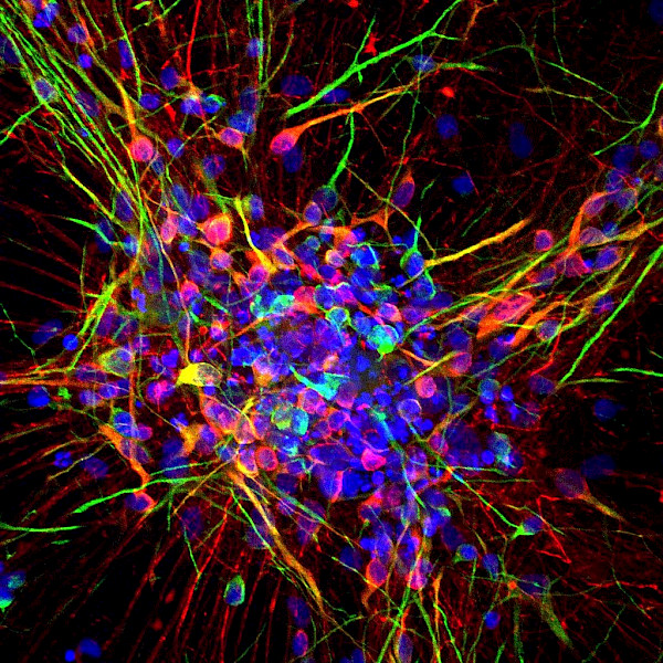 iPSC-derived GABAergic interneurons. Red-GABA, Green-MAP2, Blue-Hoechst (Nuclear staining)
