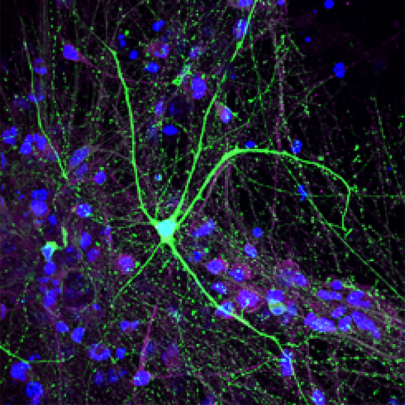 16p11.2 iPSC derived dopaminergic neurons and cortical neurons in vitro