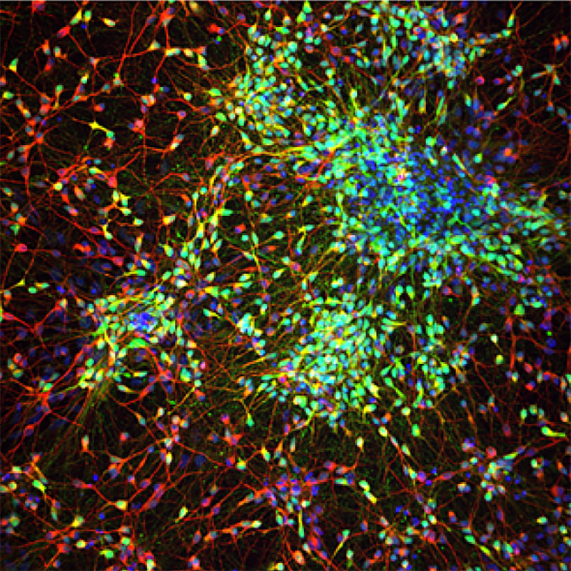 Striatal Deficits in the Development of Schizophrenia